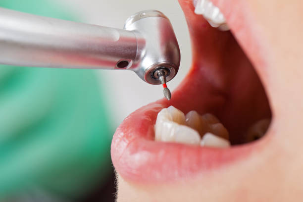 Best Tooth Pain Emergency Relief  in Shamrock, TX